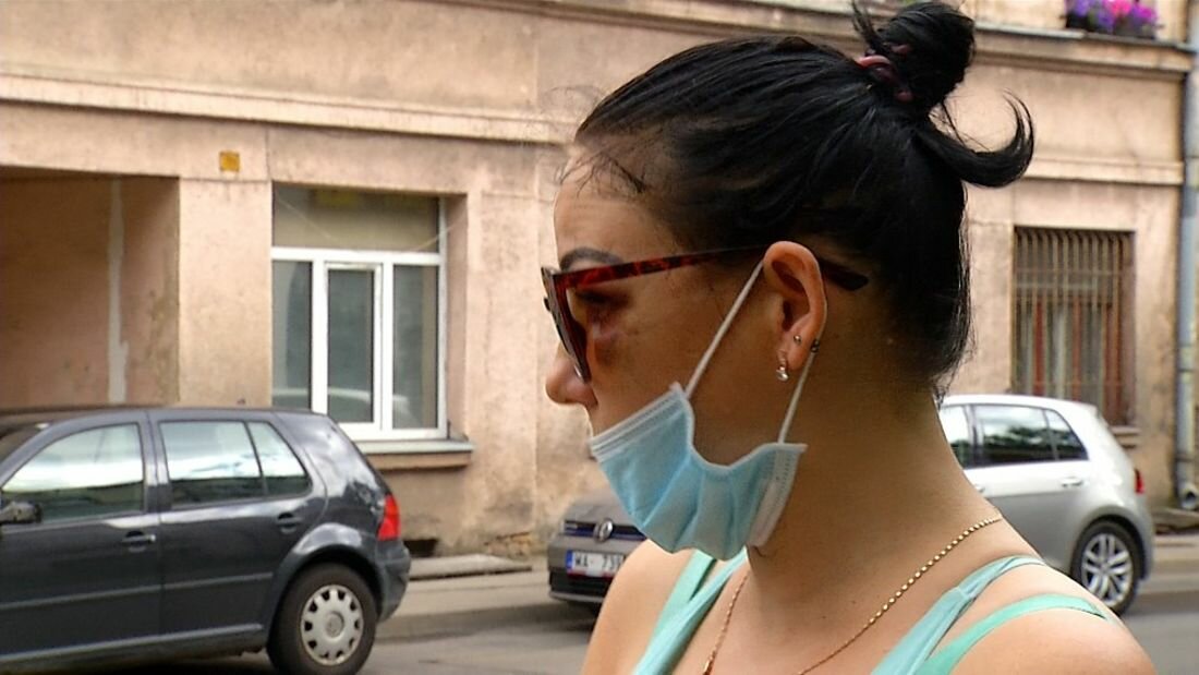 Агрессивный мужчина жестоко избил женщину в Риге; полиция отпустила преступника